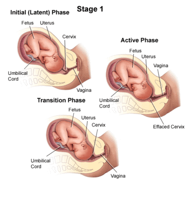 What do you understand by prolonged Labour? Write its causes and management?