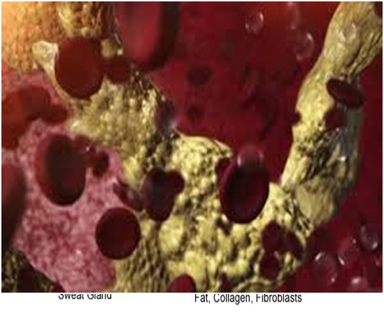 Displacement of the uterus and what is the retroversion and retroflexion?