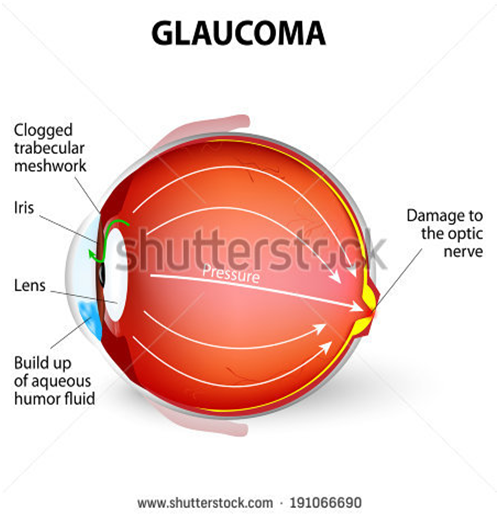 Displacement of the uterus and what is the retroversion and retroflexion?
